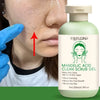 Aloe Vera Exfoliating Facial Gel